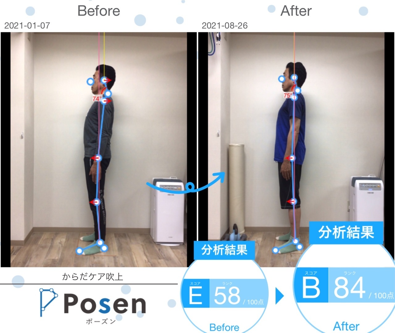 E様の姿勢分析Before After