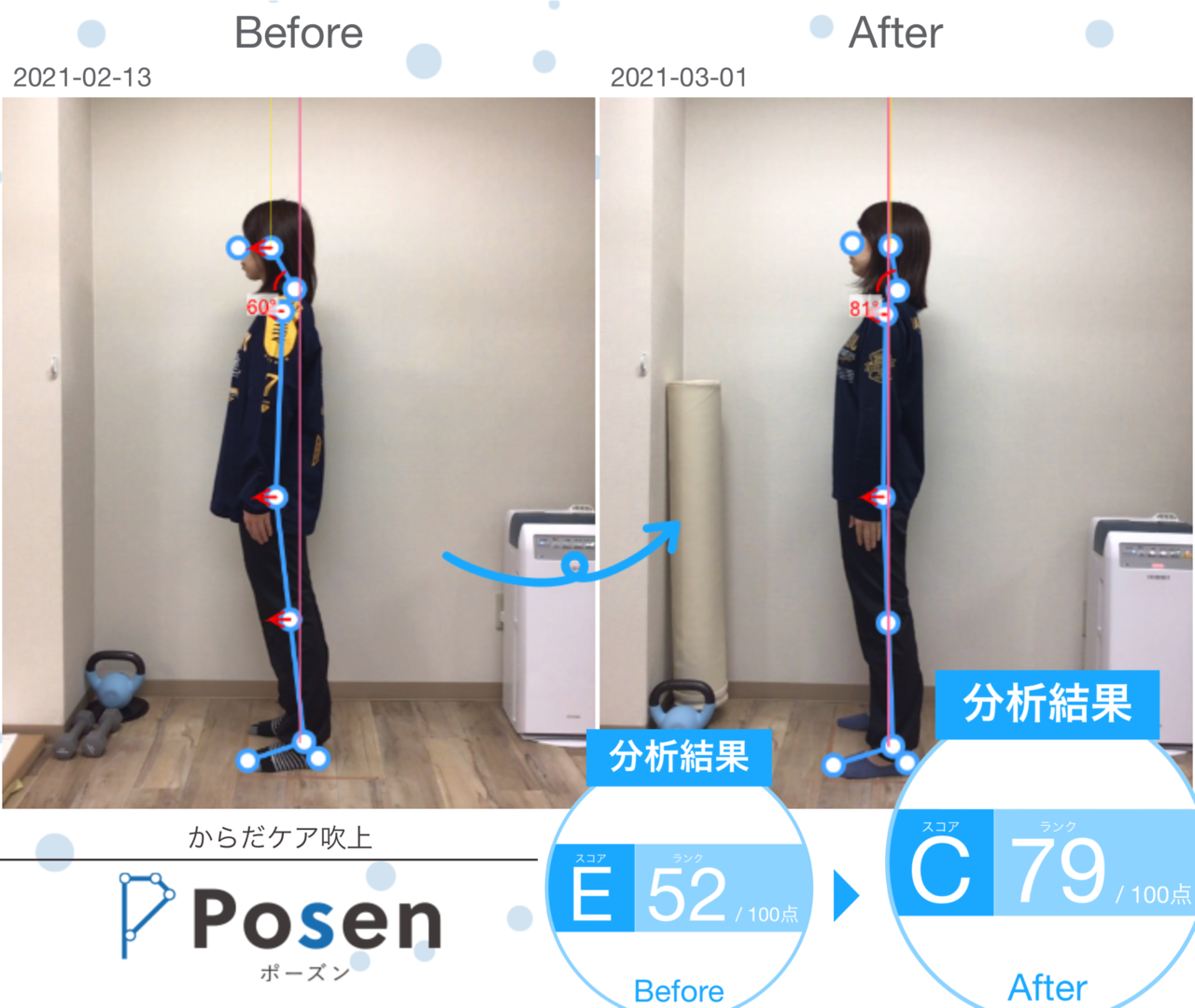 S様姿勢分析Before After